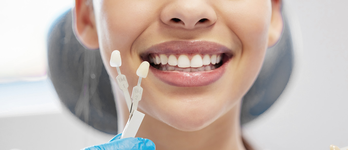 تقويم اسنان طبي - Specialist in Oral and Dental Surgery - Royal Smile Center